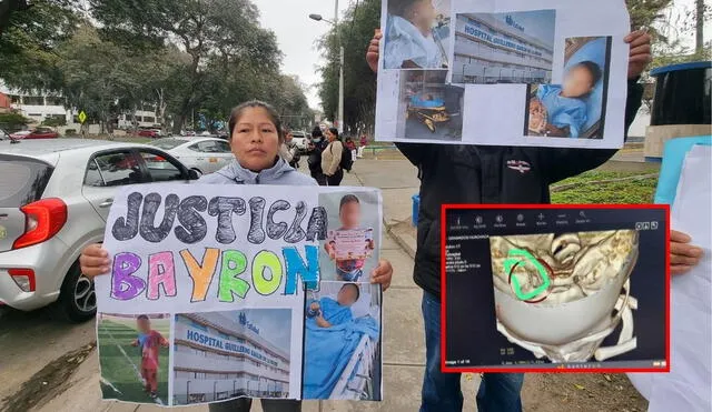 Familiares del menor exigen una pronta operación, ya que la aguja de anestesia ha estado incrustada en su cabeza durante una semana. Foto: Fiorella Alvarado/LR